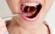Pekoč jezik kaže na pomanjkanje vitamina B1 in želodčne kisline